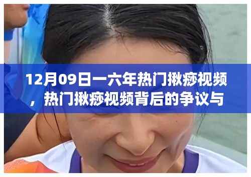 一六年热门揪痧视频背后的争议与思考,12月09日观察