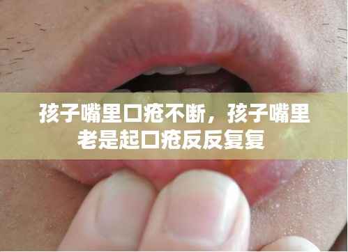 孩子嘴里口疮不断,孩子嘴里老是起口疮反反复复