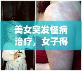 美女突发怪病治疗,女子得了怪病很多地方都治不好