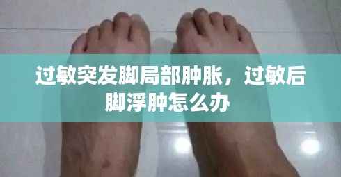 过敏突发脚局部肿胀,过敏后脚浮肿怎么办